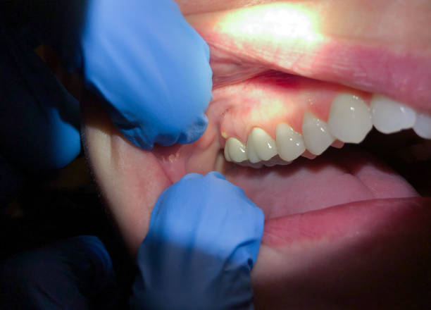 Best Emergency Orthodontic Repairs in Ridgely, MD