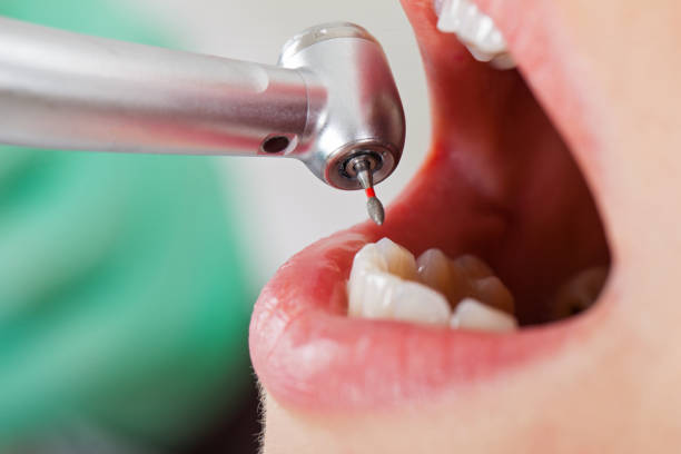 Best Pediatric Emergency Dentist in Ridgely, MD